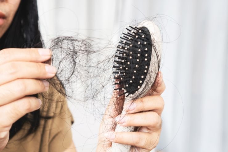 Hair-Fall