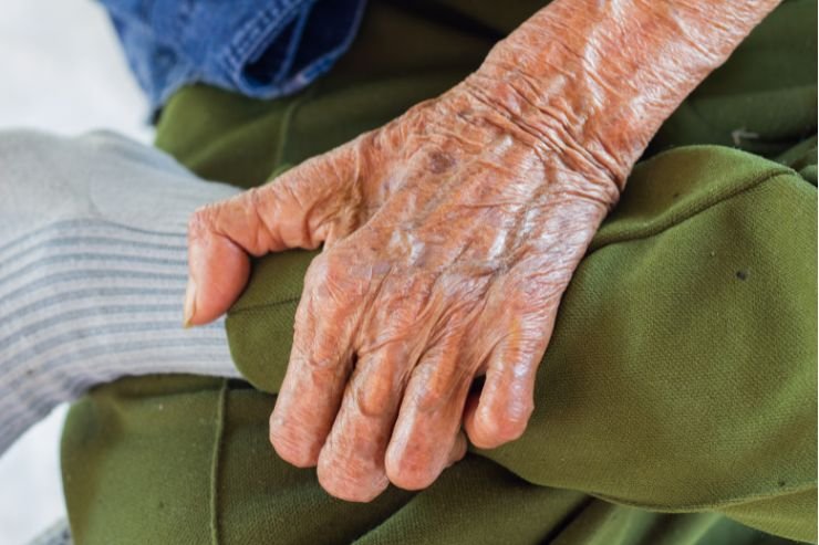 Leprosy