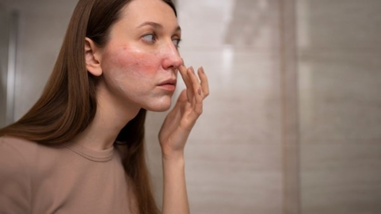 Simple-Tips-for-Managing-Cellulitis: -A-practical-Guide