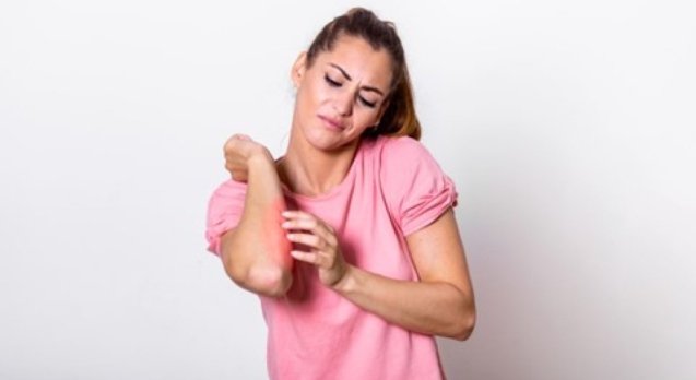 Cellulitis:-What-is-it?