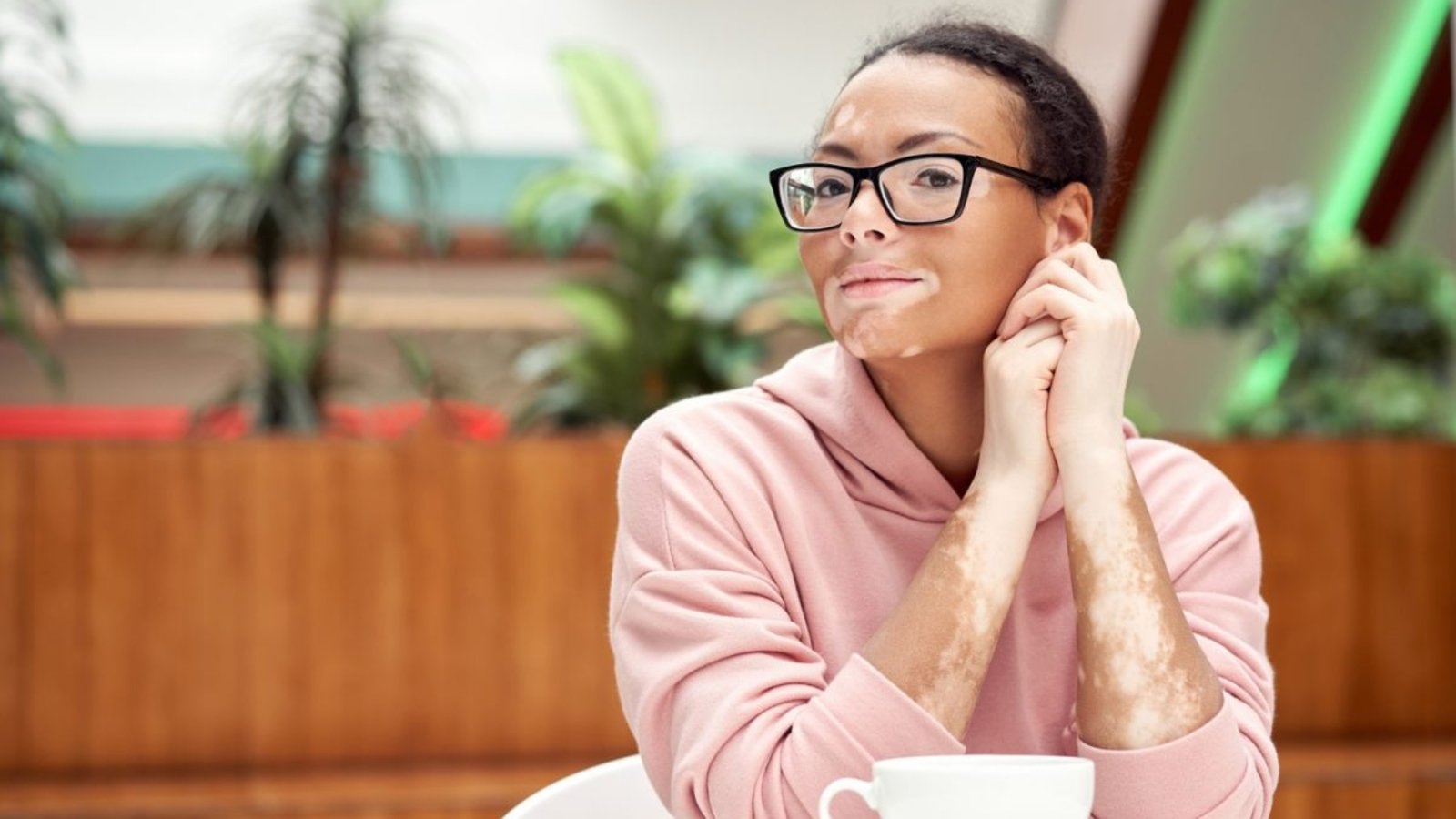 Vitiligo:-What-to-Know?-(Loss-of-skin-colour)