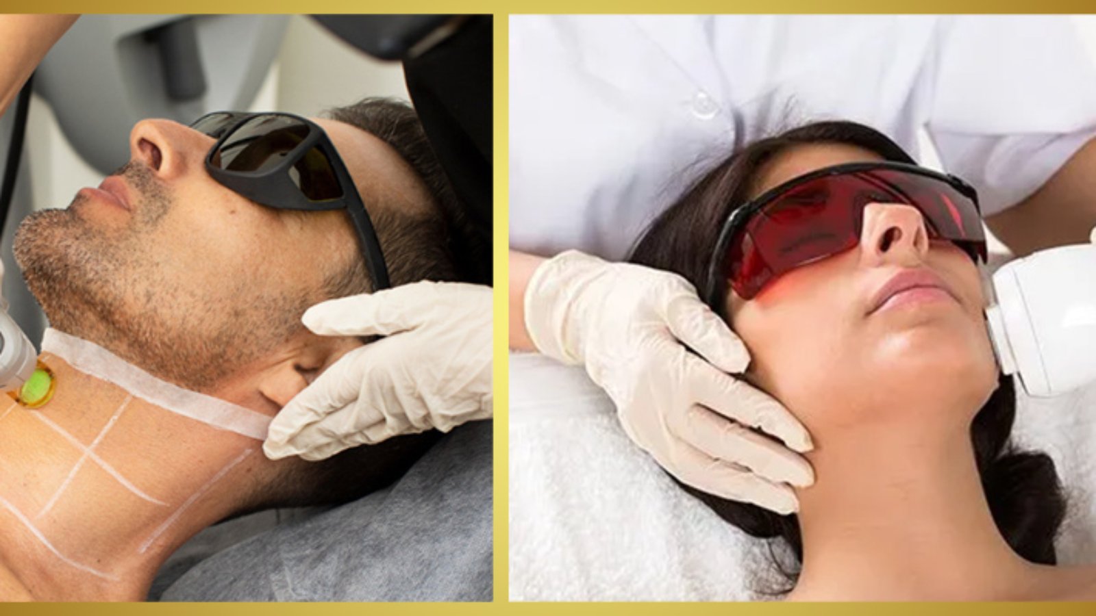 Laser Hair Reduction