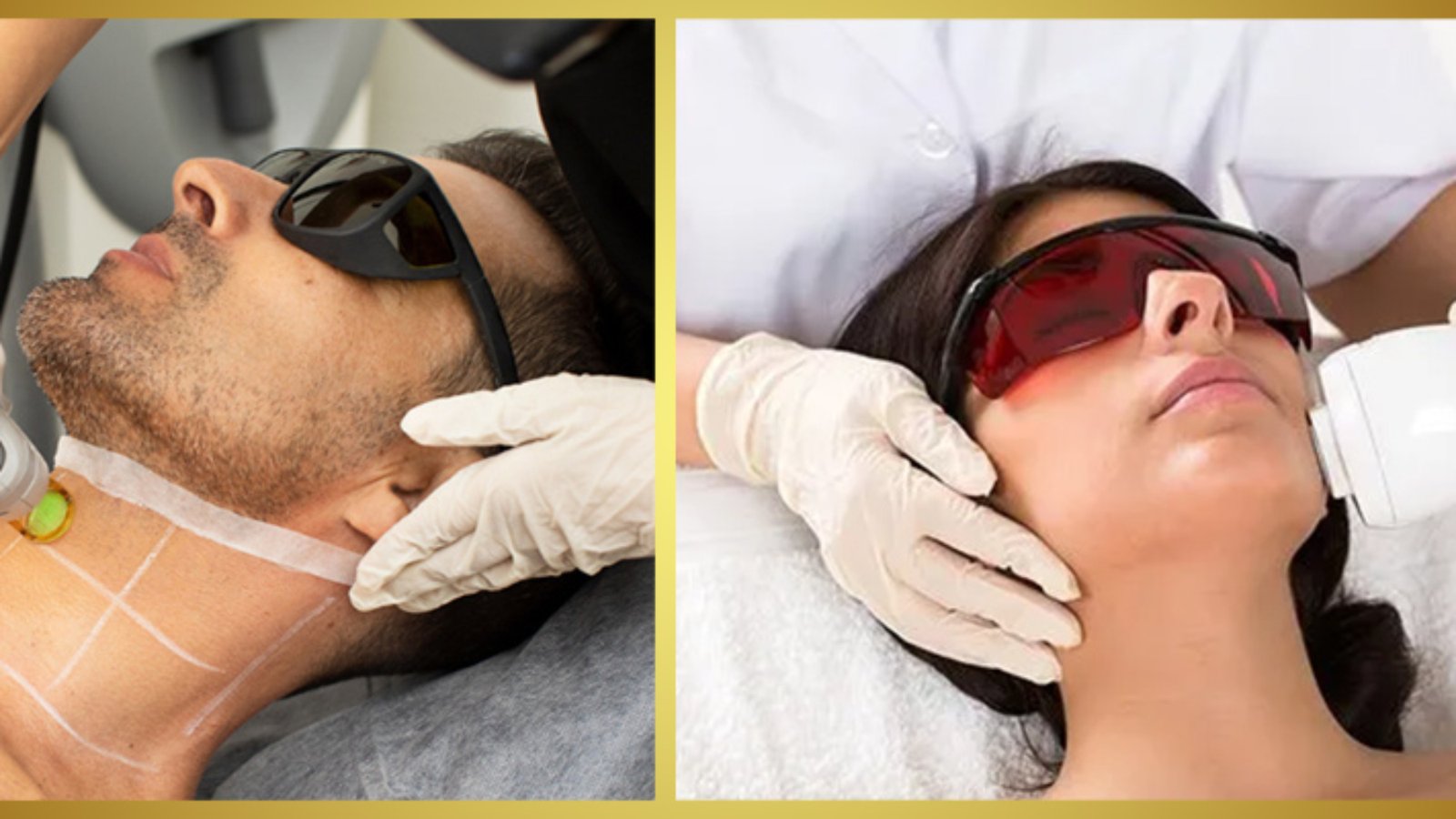 Laser Hair Reduction
