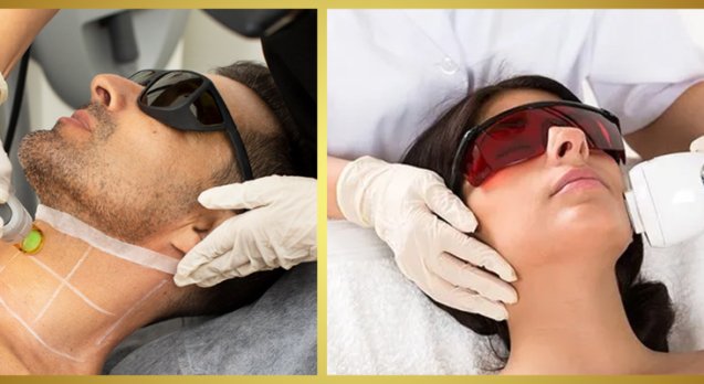 Laser Hair Reduction
