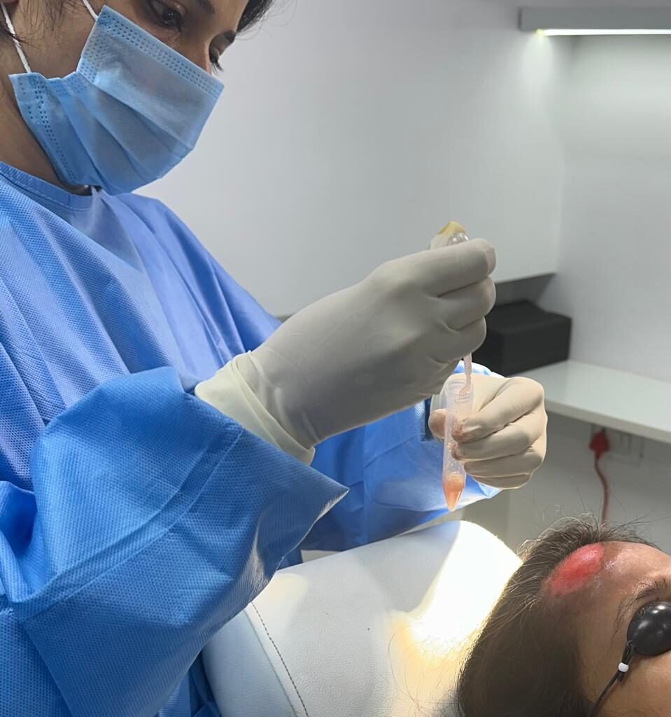 Vitiligo Treatment